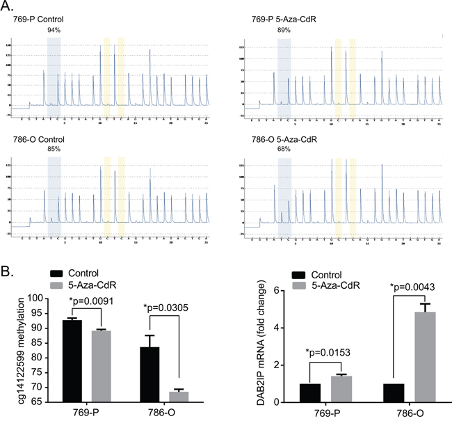 5-Aza-CdR treatment decrease DAB2IP CpG1 methylation and increase DAB2IP mRNA expression.