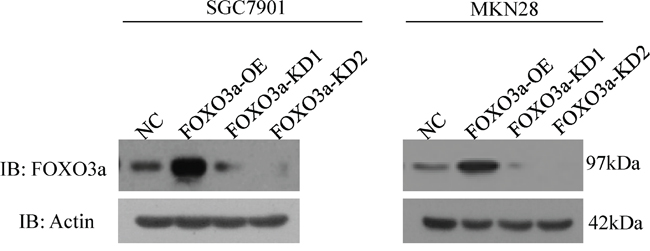 Knockdown and overexpression of FOXO3a in gastric cancer cells.