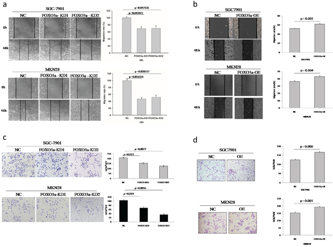 Migration and invasion assay of FOXO3a knockdown or overexpressing gastric cancer cells.