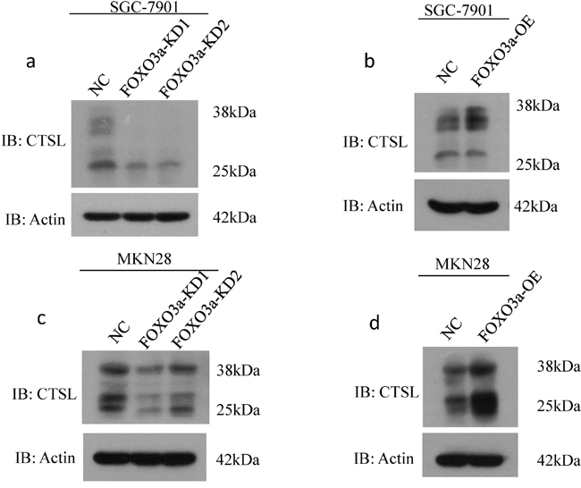 Western blot assay of cathepsin L expression in FOXO3a knockdown or overexpressing gastric cancer cells.