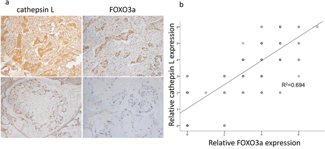 Positive correlation between FOXO3a and cathepsin L expression.