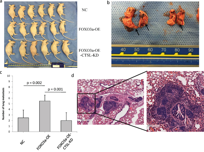 FOXO3a promoted gastric cancer cell metastasis in vivo.