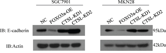 Western blot assay of E-cadherin in cathespin L knockdown or overexpression cells.