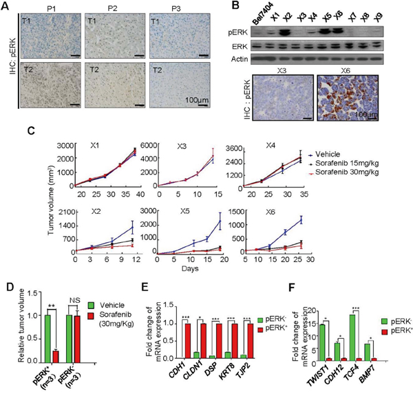 Correlation of pERK expression with sorafenib inhibition of tumor growth in patient-derived xenograft (PDX) models.