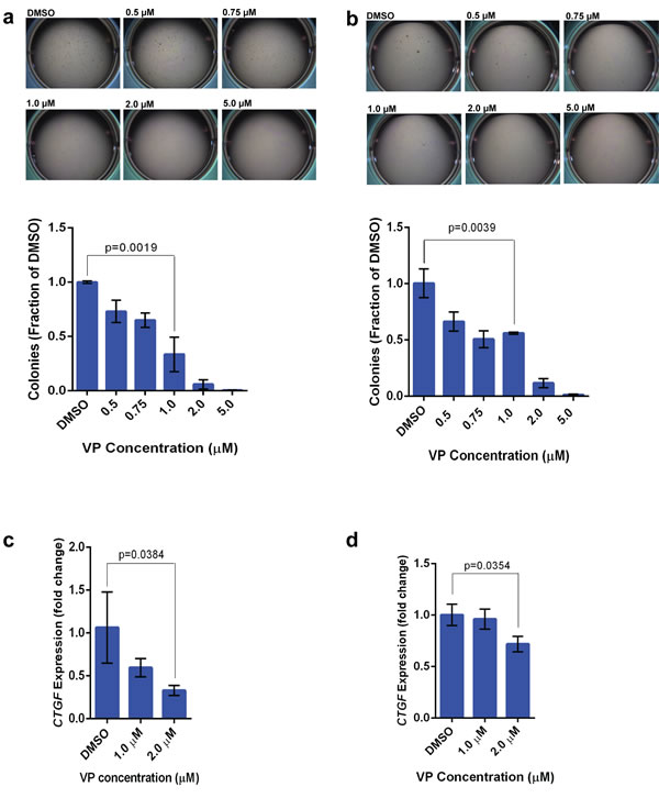 Verteporfin inhibits TAZ/YAP activity in sarcoma cells lines and abrogates colony formation in soft agar.