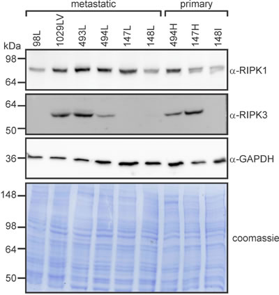 RIPK1 and RIPK3 levels vary between primary and metastatic murine osteosarcomas.