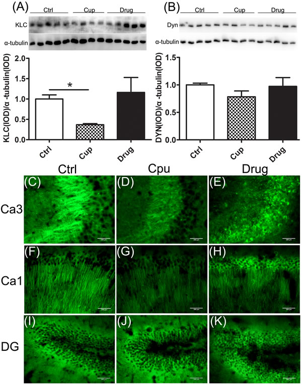 Reduction of proteins essential for axonal transport in the hippocampus.