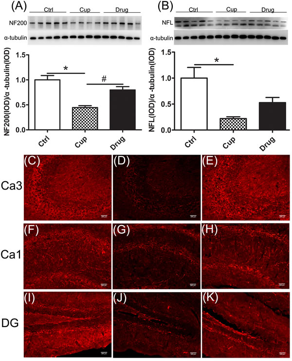 Reduction of axonal structure proteins in the hippocampus.