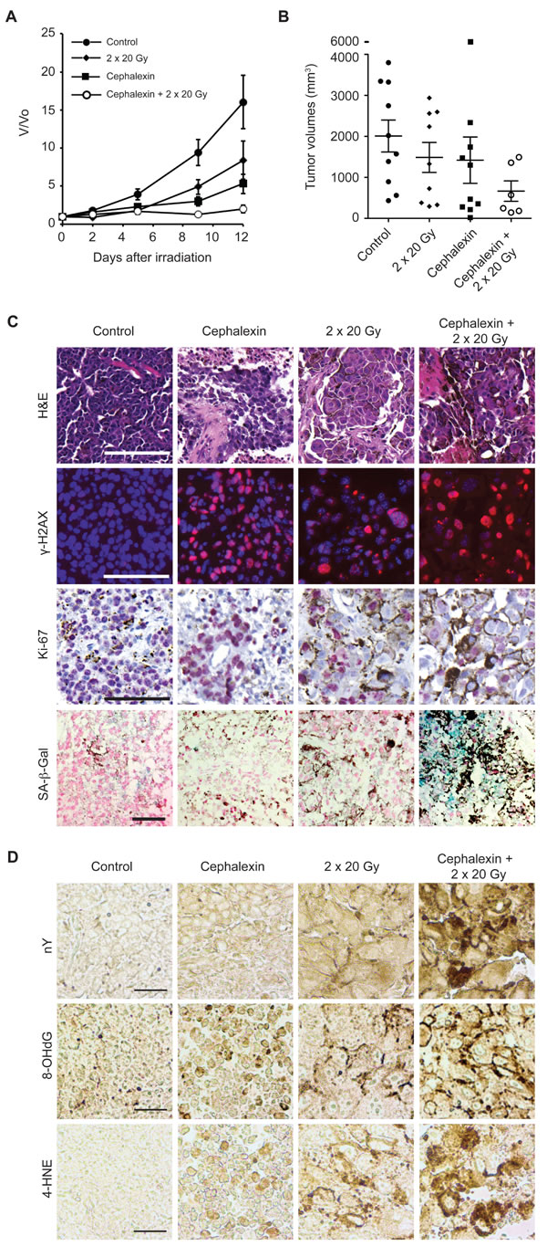 Cephalexin combined with radiation suppresses tumor growth and induces oxidative stress in B16.SIY tumors.