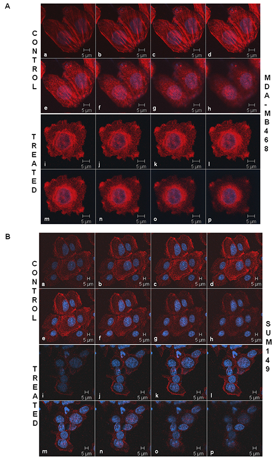 Sulindac sulfide treatment caused a loss of the cytoskeletal architecture of the filamentous actin in MDA-MB468 A. and SUM149 B. cells.