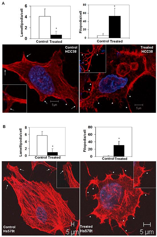 Sulindac sulfide treatment altered podia-parameters (lamellipodia and filopodia) of HCC38 A. and Hs578t B. cells.