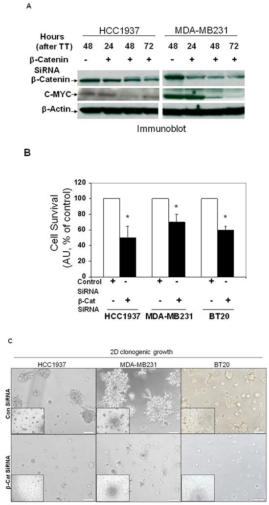 SiRNA mediated downregulation of beta-catenin and c-MYC proteins in TNBC cells (A) caused a decreased cell survival (B), blocked clonogenic 2D growth (C), blocked 3D ON-TOP growth. (D), inhibited fibronectin-directed transwell migration (E) and inhibited matrigel invasion (F).