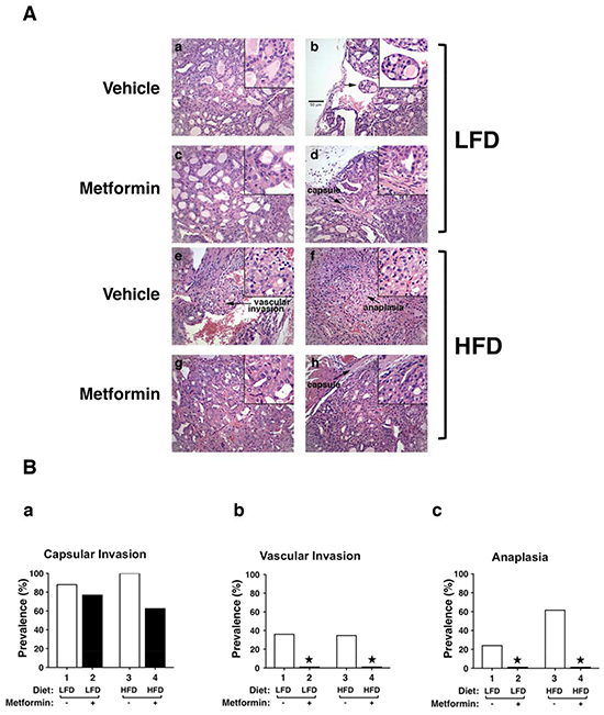 Effects of metformin on thyroid cancer progression of LFD- or HFD- ThrbPV/PV Pten+/&#x2212;mice.