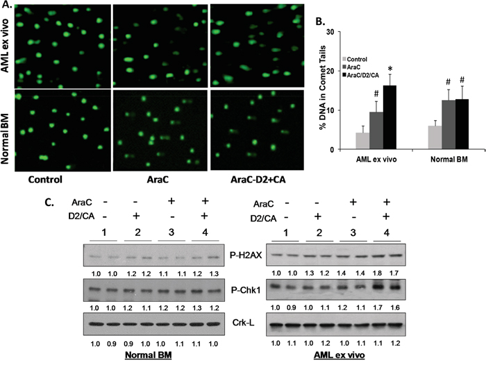 Enhancement of cell kill correlates with the evidence of DNA damage and with DNA Damage Response.