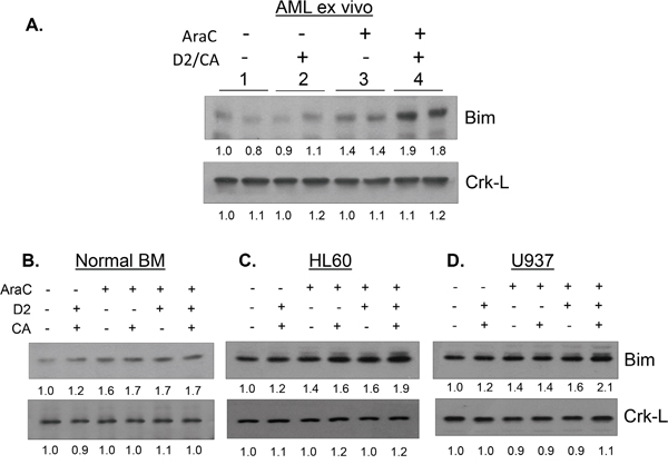 Effect of D2/CA, AraC and their combination on the expression of the pro-apoptotic protein Bim.