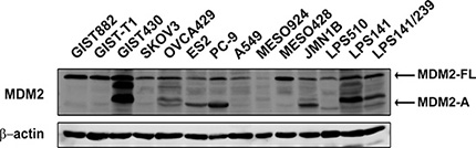 Expression of MDM2 in cancer cell lines.