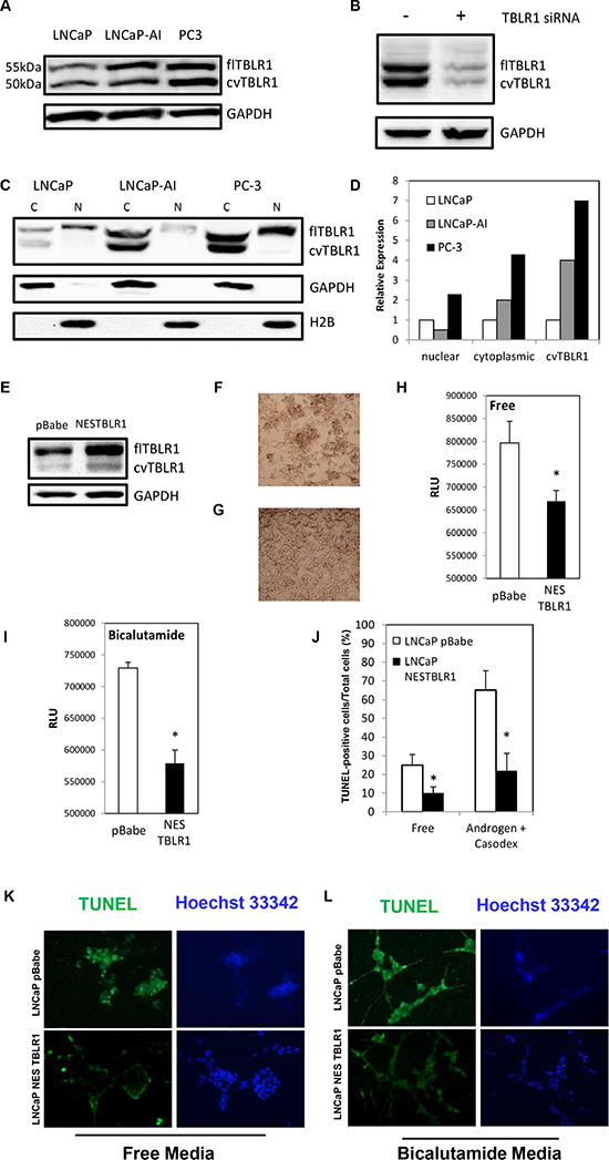 Expression of full length cytoplasmic TBLR1 (cTBLR1) and protease cleaved cytoplasmic variant of TBLR1 (cvTBLR1) in prostate cancer cells.