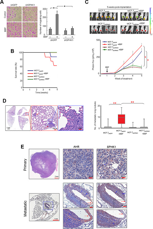 Promotion of SPHK1 during breast tumorigenesis and metastasis.