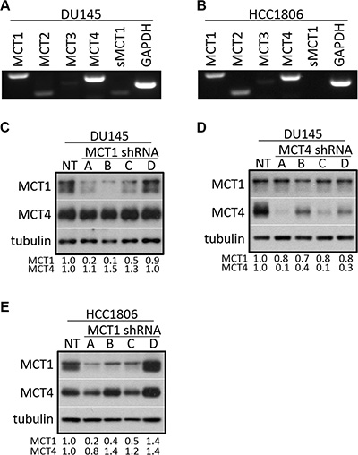 DU145 and HCC1806 cells primarily express MCT1 and MCT4.
