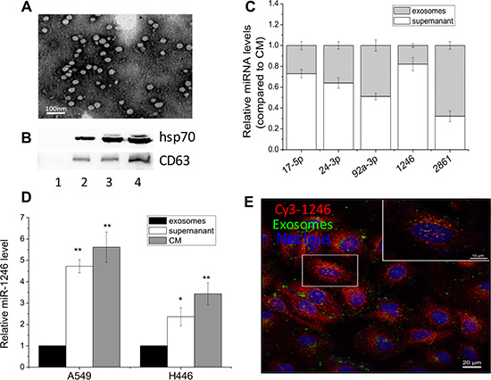 Extracellular miR-1246 exists in non-exosomes associated form.