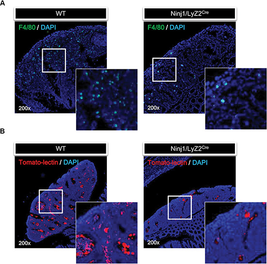 Overexpression of ninjurin 1 on macrophage results in the inhibition of tumor infiltration and angiogenesis.