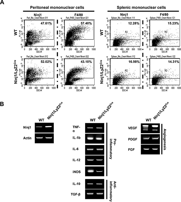 Characteristics of ninjurin 1-overexpressing macrophages.