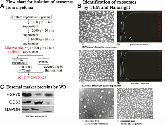 Isolation and validaton of exosomes from both U266 cell line and MM patients.