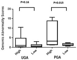 UGA and PGA score differences between high and low volume prostate cancer patients.