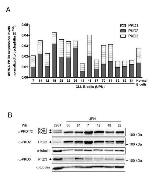 PKD2 and PKD3 are expressed in CLL cells.