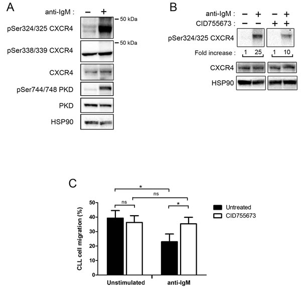 BCR engagement allows CXCR4 phosphorylation and reduces CLL migration toward CXCL12