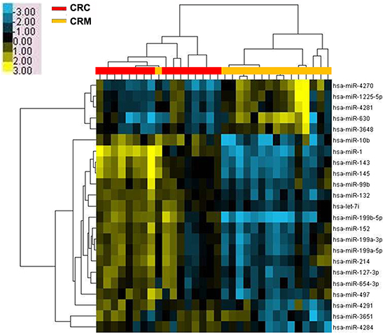 Microarray assay of miRNA expression in colorectal cancer tissues.