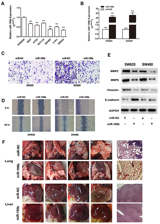 Metastasis suppressive effects of miR-199b in CRC cell lines in vitro and in vivo.