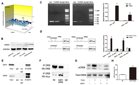 SIRT1 regulates KISS1 expression through deacetylation of transcription factor CREB.