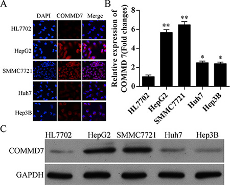 Expression of COMMD7 is also up-regulated in hepatocellular carcinoma cells.