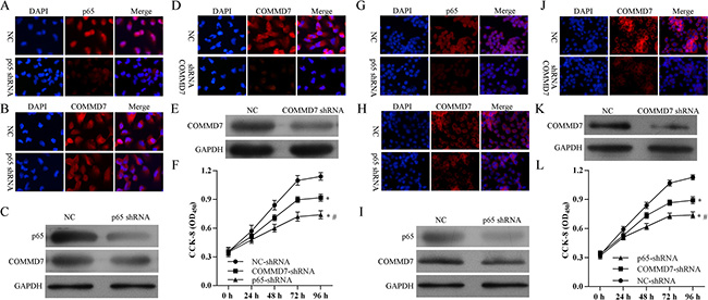 Stable transfection of NF-&#x03BA;B shRNA or COMMD7 shRNA inhibited the proliferation of hepatocellular carcinoma cells.