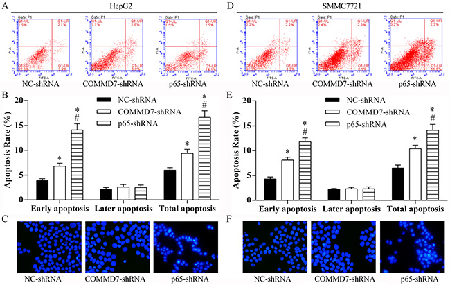 Stable transfection of NF-&#x03BA;B shRNA or COMMD7 shRNA enhanced apoptosis of hepatocellular carcinoma cells.