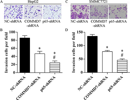 Stable transfection of NF-&#x03BA;B shRNA or COMMD7 shRNA suppressed the invasion of hepatocellular carcinoma cells.