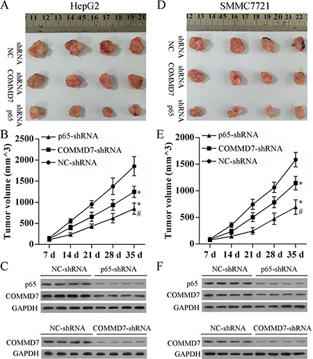 Stable transfection of NF-&#x03BA;B shRNA or COMMD7 shRNA suppressed tumorigenicity in vivo.