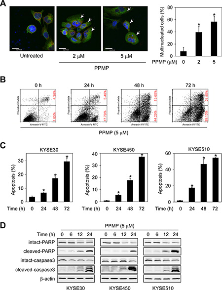 PPMP induces multinucleation and apoptosis in human esophageal cancer cells.