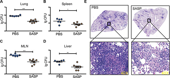 Disruption of xCT by SASP enhanced mycobacteria clearance in mice infected with Mtb.