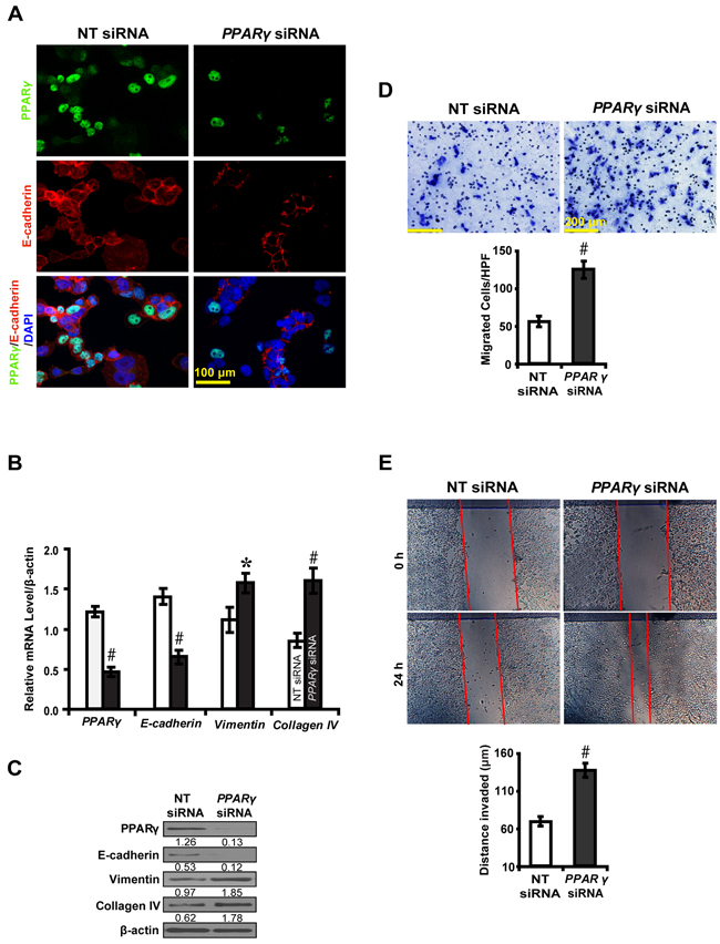 PPAR&#x03B3; siRNA promotes EMT in high glucose cultured NRK-52E cells.