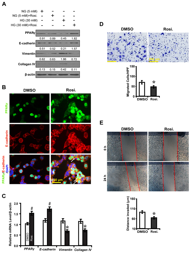 PPAR&#x03B3; agonist rosiglitazone inhibits EMT in high glucose cultured NRK-52E cells.