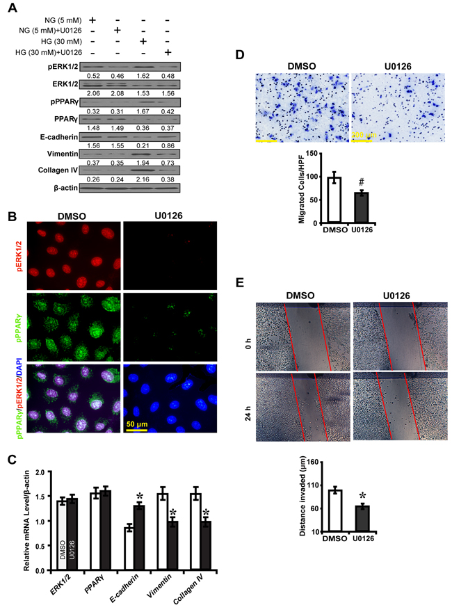 U0126 inhibits PPAR&#x03B3;-mediated EMT in high glucose cultured NRK-52E cells.