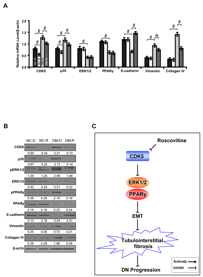 Roscovitine inhibits EMT and fibrosis in diabetic rats.