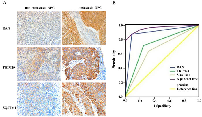Expressional changes of TRIM29, RAN, and SQSTM1 in NPC tissues and their efficacy in discriminating metastatic NPC from non-metastatic NPC.