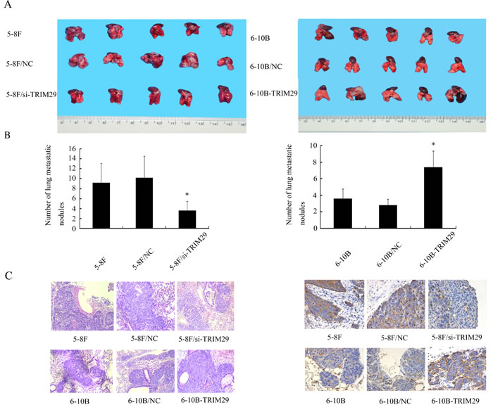 The effect of TRIM29 on NPC cell metastasis