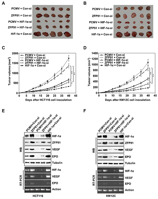 ZFP91 promotes the tumor growth through HIF-1&#x03B1; in mice.
