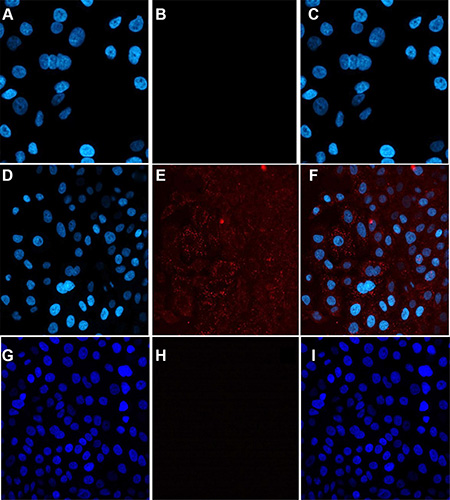 The internalization of compound 7 into A549 cells imaged by confocal microscopy.