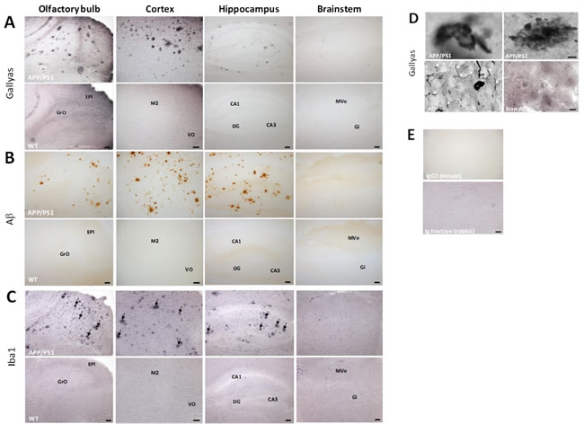 Figure 6:Immunostaining of argyrophilic tau protein, A&szlig; plaques and microglia clusters and specificity of Gallyas staining using human post-mortem brain samples.