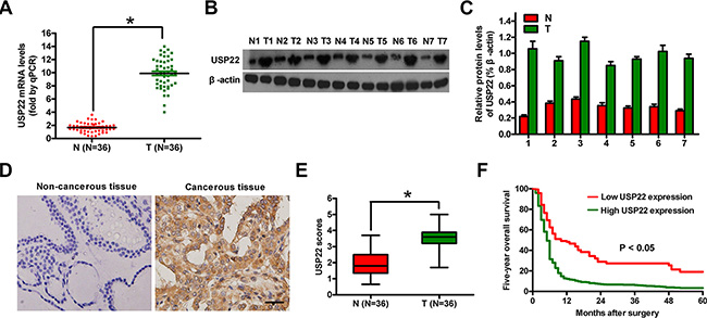 USP22 expression in ATC tissue samples and its association with prognosis.